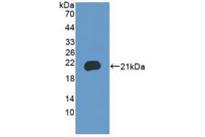 Figure. (BRD8 antibody  (AA 797-951))