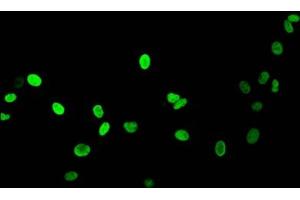 Immunofluorescent analysis of HepG2 cells (sodium butyrate, 30 mM, 4h) using ABIN7139164 at dilution of 1:100 and Alexa Fluor 488-congugated AffiniPure Goat Anti-Rabbit IgG(H+L) (Histone H1.5 antibody  (acLys16))