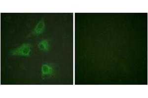 Immunofluorescence analysis of HeLa cells, using DRP-2 (Ab-514) Antibody. (DRP2 antibody  (AA 480-529))