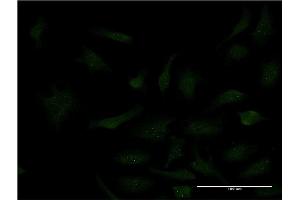 Immunofluorescence of monoclonal antibody to SP3 on HeLa cell. (Sp3 antibody  (AA 287-430))