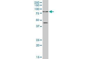 PIAS2 MaxPab rabbit polyclonal antibody. (PIAS2 antibody  (AA 1-572))