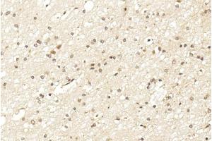 Immunohistochemistry (IHC) image for anti-Leucine Rich Repeat and Ig Domain Containing 1 (LINGO1) (AA 575-603), (C-Term) antibody (ABIN651289)