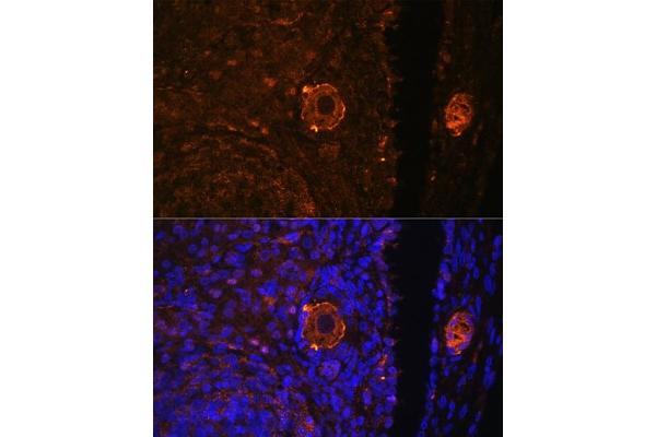 Zona Pellucida Glycoprotein 3 antibody  (AA 170-390)