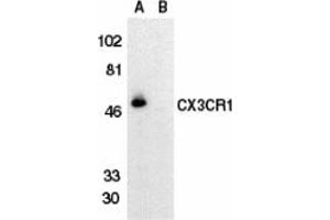 Image no. 2 for anti-Chemokine (C-X3-C Motif) Receptor 1 (CX3CR1) antibody (ABIN203578) (CX3CR1 antibody)