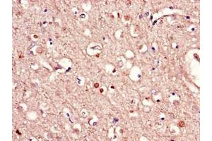 Immunohistochemistry of paraffin-embedded human brain tissue using ABIN7167318 at dilution of 1:100 (RAB39B antibody  (AA 1-213))