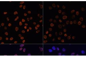 Immunofluorescence analysis of HeLa cells using Acetyl-Histone H2A-K5 Polyclonal Antibody at dilution of 1:100.