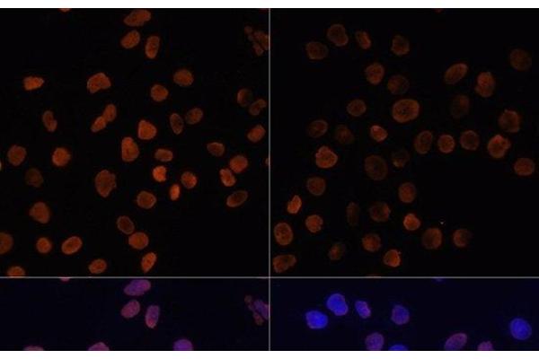 Histone H2A antibody  (acLys5)