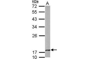Figure 3. (CRYbA4 antibody  (N-Term))