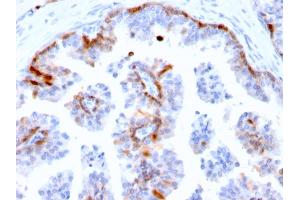 Formalin-fixed, paraffin-embedded human Prostate stained with Cystatin A Mouse Monoclonal Antibody (CSTA/2882). (CSTA antibody  (AA 1-98))
