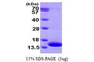 SDS-PAGE (SDS) image for Mitogen-Activated Protein Kinase Kinase 1 Interacting Protein 1 (MAPKSP1) (AA 1-124) protein (His tag) (ABIN667282) (MAPKSP1 Protein (AA 1-124) (His tag))