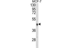 Western Blotting (WB) image for anti-Trans-Golgi Network Protein 2 (TGOLN2) antibody (ABIN3003981)