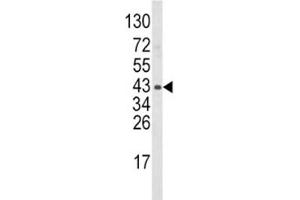 Western Blotting (WB) image for anti-Wingless-Type MMTV Integration Site Family, Member 5B (WNT5B) (AA 153-182) antibody (ABIN3029636)