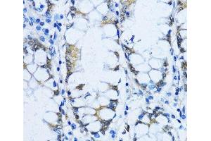 Immunohistochemistry of paraffin-embedded Human stomach using VIL1 Polyclonal Antibody at dilution of 1:100 (40x lens). (Villin 1 antibody)