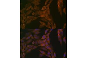 Immunofluorescence analysis of NIH-3T3 cells using PP2A alpha + beta Rabbit mAb (ABIN7269686) at dilution of 1:100 (40x lens). (PPP2CB antibody)