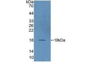 Detection of Recombinant DUSP5, Human using Polyclonal Antibody to Dual Specificity Phosphatase 5 (DUSP5) (DUSP5 antibody  (AA 1-135))