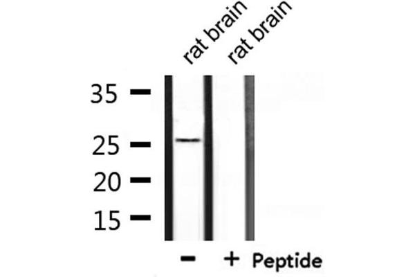 RAB38 antibody  (Internal Region)