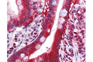 anti-Fat Mass and Obesity-Associated (FTO) (N-Term) antibody