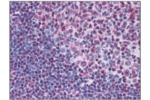 Immunohistochemistry (Paraffin-embedded Sections) (IHC (p)) image for anti-V-Myb Myeloblastosis Viral Oncogene Homolog (Avian) (MYB) (N-Term) antibody (ABIN784094)