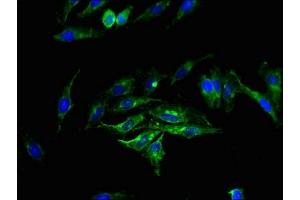 Immunofluorescence staining of Hela cells with ABIN7163135 at 1:200, counter-stained with DAPI. (Sphingomyelin Synthase 2 antibody  (AA 1-79))