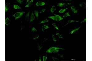 Immunofluorescence of purified MaxPab antibody to OXA1L on HeLa cell.