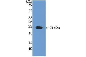 Detection of Recombinant NRP1, Human using Monoclonal Antibody to Neuropilin 1 (NRP1) (Neuropilin 1 antibody  (AA 646-814))