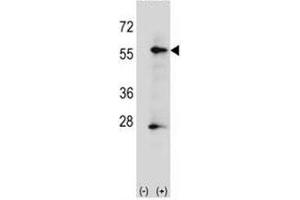 Western blot analysis of placental Alkaline Phosphatase antibody and 293 cell lysate (2 ug/lane) either nontransfected (Lane 1) or transiently transfected (2) with the ALPP gene. (Alkaline Phosphatase antibody  (AA 56-83))