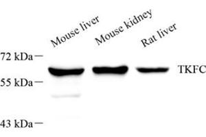 Western blot analysis of DAK (ABIN7073737),at dilution of 1: 1000,Lane 1: Mouse liver tissue lysate,Lane 2: Mouse kidney tissue lysate,Lane 3: Rat liver tissue lysate