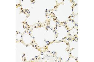 Immunohistochemistry of paraffin-embedded rat lung using SUZ12 antibody (ABIN5975314) at dilution of 1/100 (40x lens). (SUZ12 antibody)