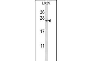 COPZ1 Antibody (N-term) (ABIN657051 and ABIN2846218) western blot analysis in  cell line lysates (35 μg/lane). (COPZ1 antibody  (N-Term))