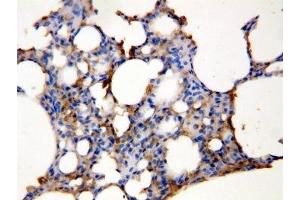 IHC-P: Aquaporin 5 antibody testing of rat lung tissue lysate (Aquaporin 5 antibody  (C-Term))