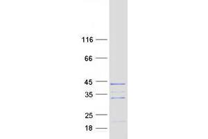 Validation with Western Blot (RNF41 Protein (Transcript Variant 2) (Myc-DYKDDDDK Tag))