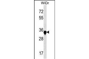 Western blot analysis in WiDr cell line lysates (35ug/lane). (AMMECR1 antibody  (C-Term))
