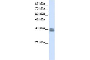 WB Suggested Anti-CACNG4 Antibody Titration:  0. (CACNG4 antibody  (N-Term))