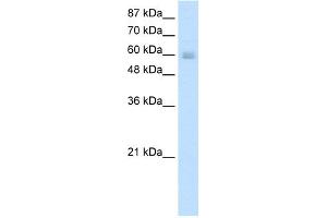 WB Suggested Anti-NKX6-3 Antibody Titration:  5. (NK6 Homeobox 3 antibody  (N-Term))