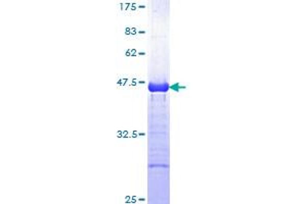 CBL Protein (AA 736-835) (GST tag)