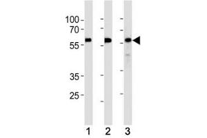 KLF4 antibody western blot analysis in (1) HeLa,(2) MCF-7 and (3) SW480 lysate.