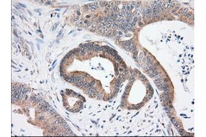 Immunohistochemical staining of paraffin-embedded Human thyroid tissue using anti-USP5 mouse monoclonal antibody.