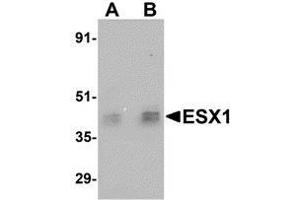 Western blot analysis of ESX1 in human testis tissue lysate with AP30320PU-N ESX1 antibody at (A) 1 and (B) 2 μg/ml. (ESX Homeobox 1 antibody  (Center))