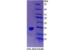 SDS-PAGE analysis of Mouse IDO2 Protein.