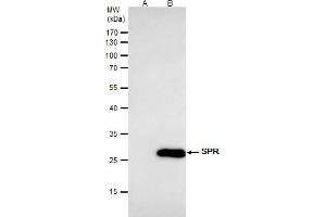 IP Image SPR antibody [N2C3] immunoprecipitates SPR protein in IP experiments.