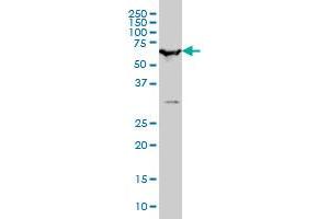 SMARCD2 monoclonal antibody (M01), clone 2F7 Western Blot analysis of SMARCD2 expression in Hela S3 NE . (SMARCD2 antibody  (AA 398-474))