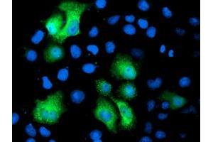 Anti-PGAM2 mouse monoclonal antibody (ABIN2454954) immunofluorescent staining of COS7 cells transiently transfected by pCMV6-ENTRY PGAM2 (RC200701). (PGAM2 antibody)