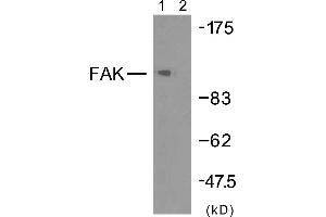 Western blot analysis of extracts from HeLa cells using FAK (Ab-925) antibody (#B7083). (FAK antibody  (Tyr925))