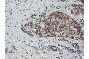 Image no. 2 for anti-Negative Regulator of Ubiquitin-Like Proteins 1 (NUB1) (AA 1-326) antibody (ABIN1490743) (NUB1 antibody  (AA 1-326))
