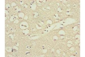 Immunohistochemistry of paraffin-embedded human brain tissue using ABIN7157675 at dilution of 1:100