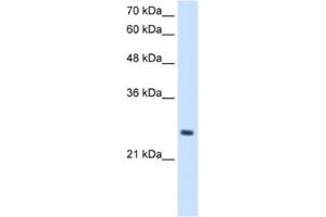 Western Blotting (WB) image for anti-phosphopantothenoylcysteine Decarboxylase (PPCDC) antibody (ABIN2462970)
