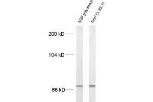 dilution: 1 : 1000, sample: crude synaptosomal fraction of rat brain (P2) (NSF antibody  (AA 733-744))
