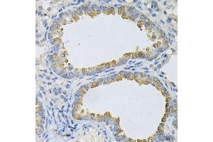 Immunohistochemistry of paraffin-embedded mouse lung using AP2B1 Antibody. (AP2B1 antibody  (AA 752-951))