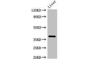 Western Blot Positive WB detected in: Rat liver tissue All lanes: PRKAG1 antibody at 3 μg/mL Secondary Goat polyclonal to rabbit IgG at 1/50000 dilution Predicted band size: 38, 35, 39 kDa Observed band size: 38 kDa (PRKAG1 antibody  (AA 1-331))