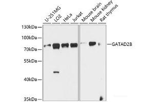 Western blot analysis of extracts of various cell lines using GATAD2B Polyclonal Antibody at dilution of 1:1000. (GATAD2B antibody)